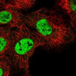 RNF26 Antibody, Novus Biologicals 25 &mu;L; Unlabeled:Antibodies, Polyclonal